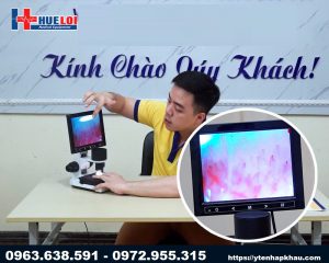 Kính hiển vi soi mạch máu giá rẻ